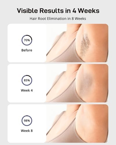 Depiladora IPL Ice Cooling: ¡La Libertad de una Piel Suave y Sin Dolor en Casa!